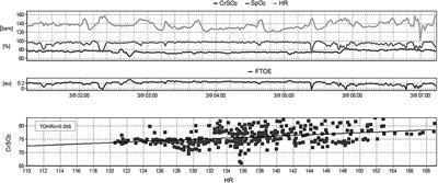 Cerebral Oxygenation and Autoregulation in Very Preterm Infants Developing IVH During the Transitional Period: A Pilot Study